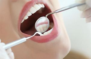 口腔全面檢查定制方案