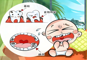 乳牙蛀牙要補牙嗎？深圳補牙價錢？