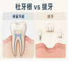 大牙蛀牙比較嚴重！杜牙根VS拔牙？深圳睇牙收費