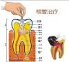 為什麼要杜牙根？深圳牙科杜牙根推薦？