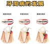 牙周炎可以根治嗎？深圳看牙哪間好？