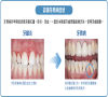 點樣預防牙周病？深圳牙科推介？