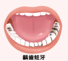 蛀牙了刷牙能制止住吗？深圳睇牙哪间好？