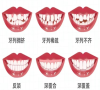你的牙齒需要矯正嗎？深圳箍牙邊間好？