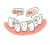 乳牙什麼情況建議拔除？深圳拔牙推薦？