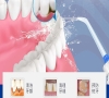 洗牙有什麼作用？深圳洗牙會痛嗎？
