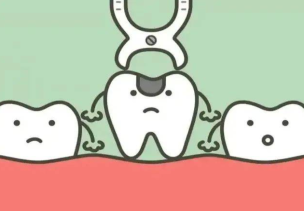 拔牙後鄰牙會鬆動嗎？深圳拔牙推薦？