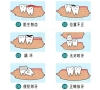 智慧齒一定要拔除嗎？深圳拔牙價錢