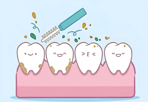 洗牙會損傷牙齒嗎？北上深圳洗牙哪間好？