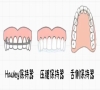牙齒保持器多久換一次？深圳箍牙好唔好？