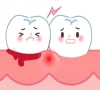 牙周病能自愈嗎？深圳牙周治療邊間好？