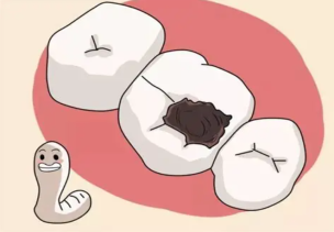 補過的牙還會壞嗎？深圳補牙價錢？