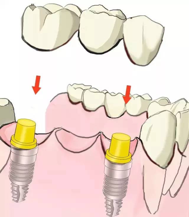 3778ebbfd4454f2bab509c8084610ad2