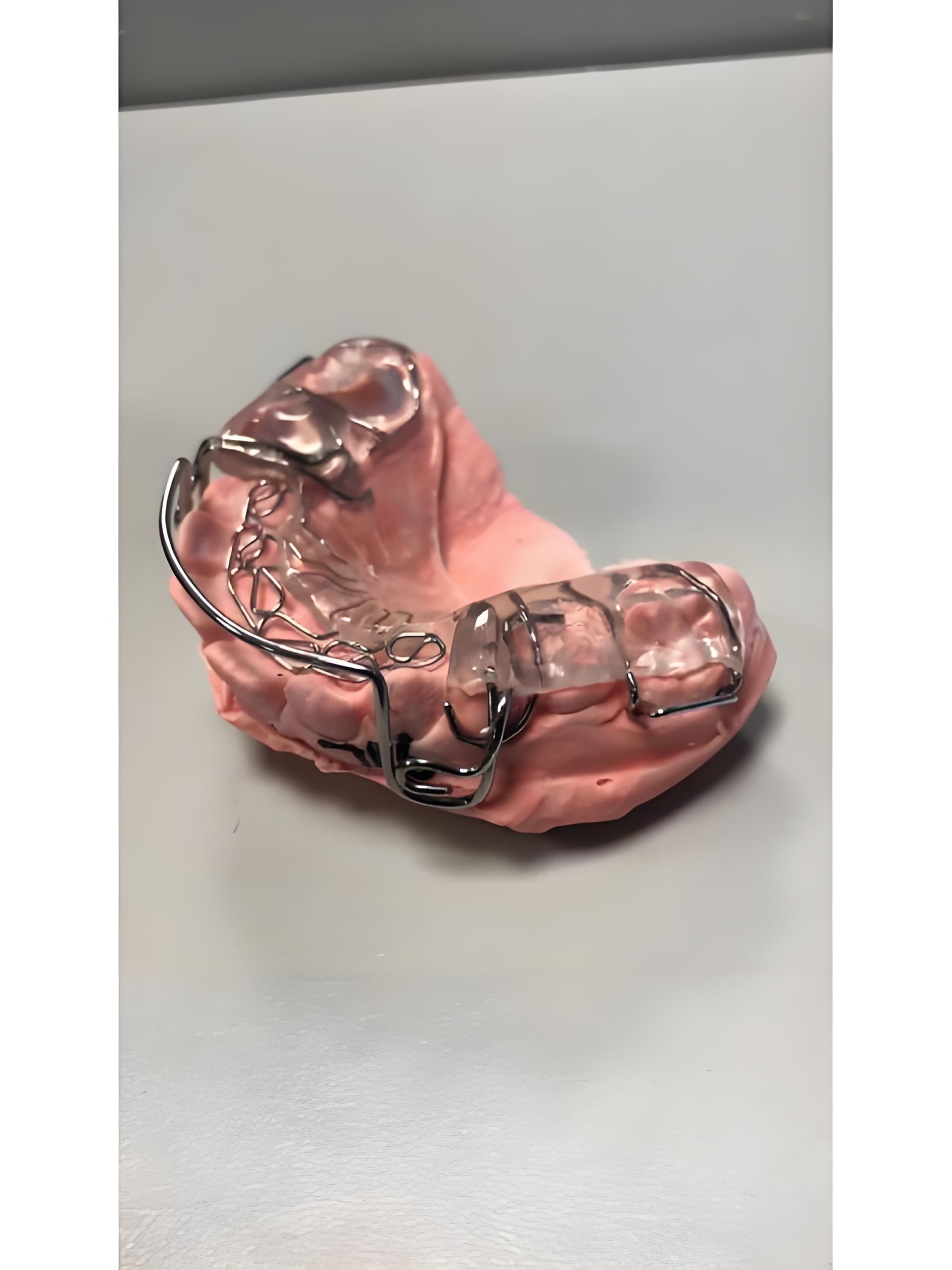 维港口腔活動矯治器