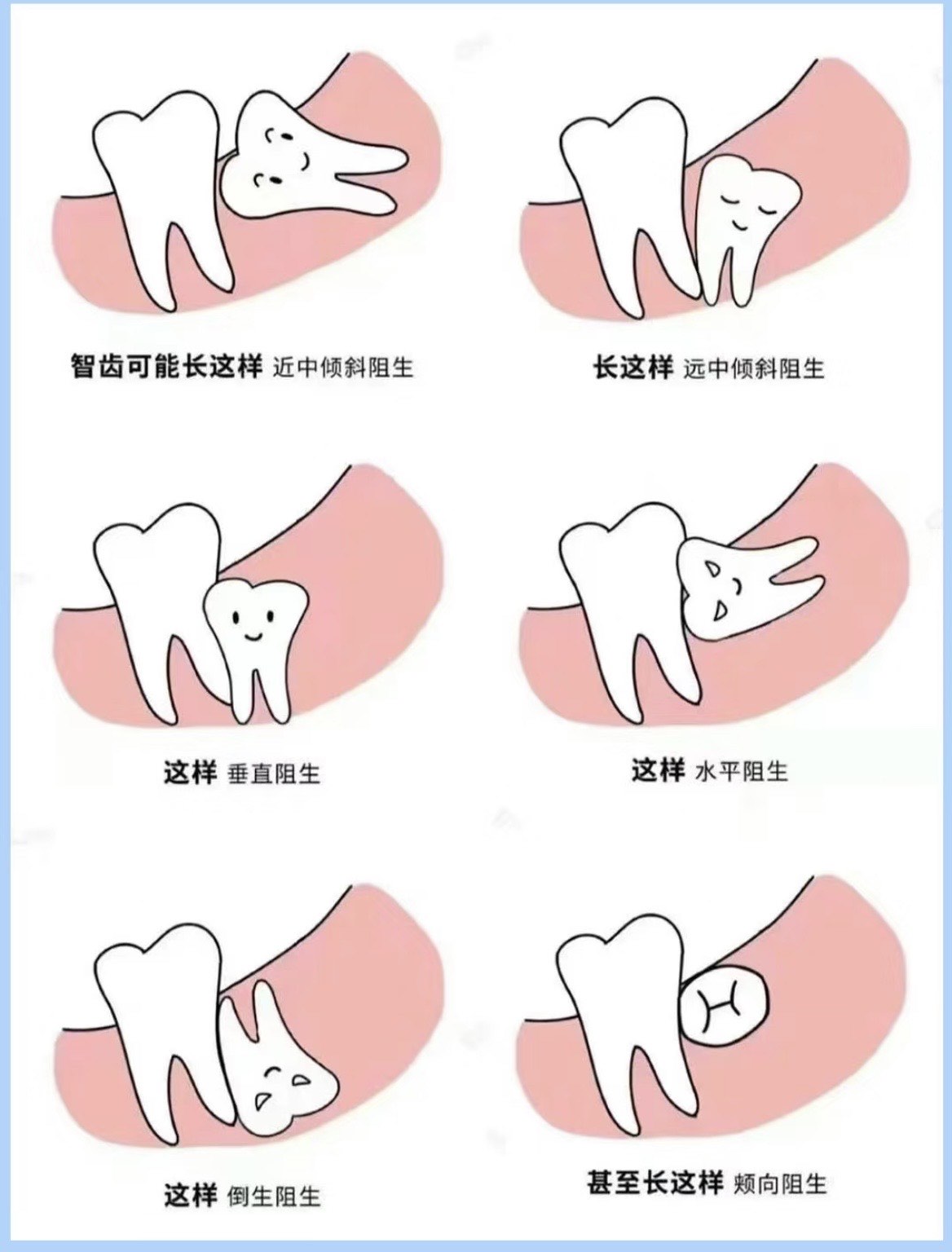 维港口腔拔智齿