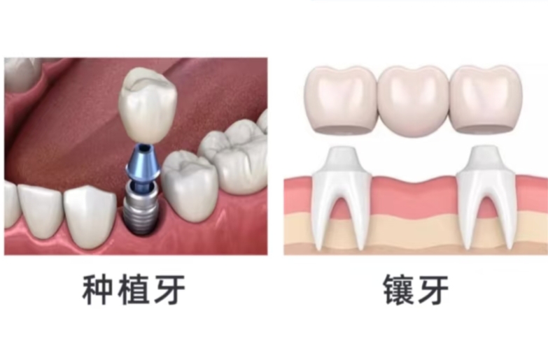 維港三康牙科
