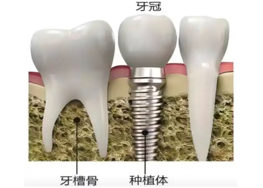 維港三康牙科