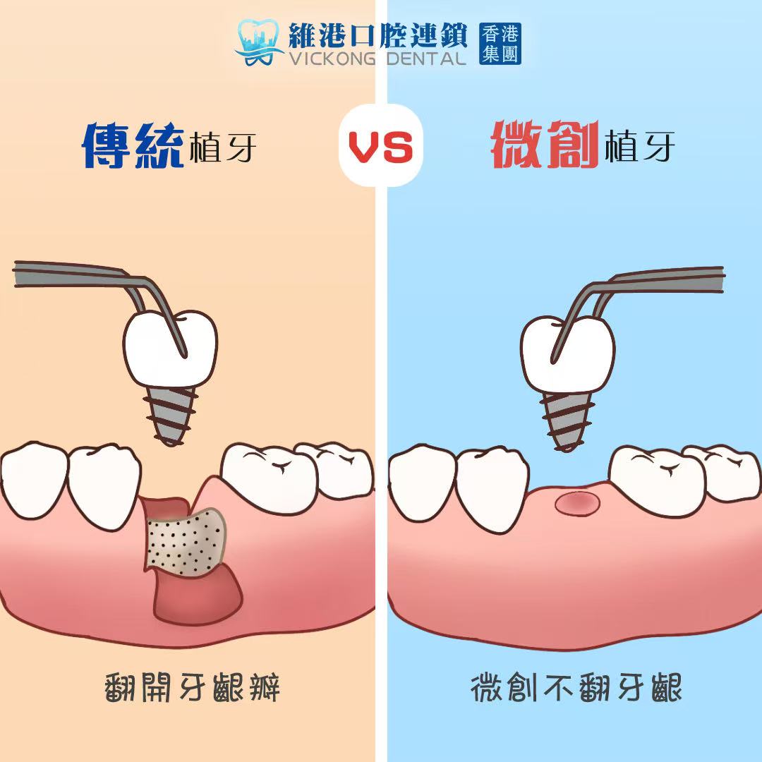 维港三康微创技术