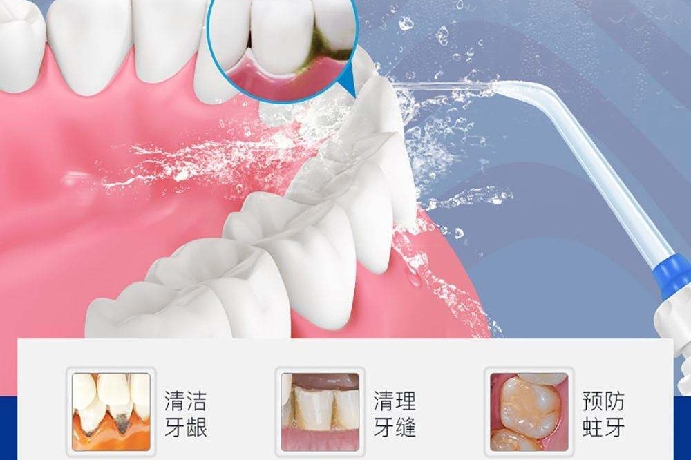 深圳维港三康口腔洗牙