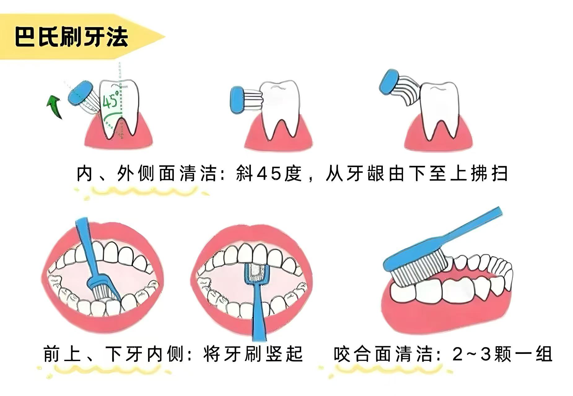 三康口腔巴氏刷牙法