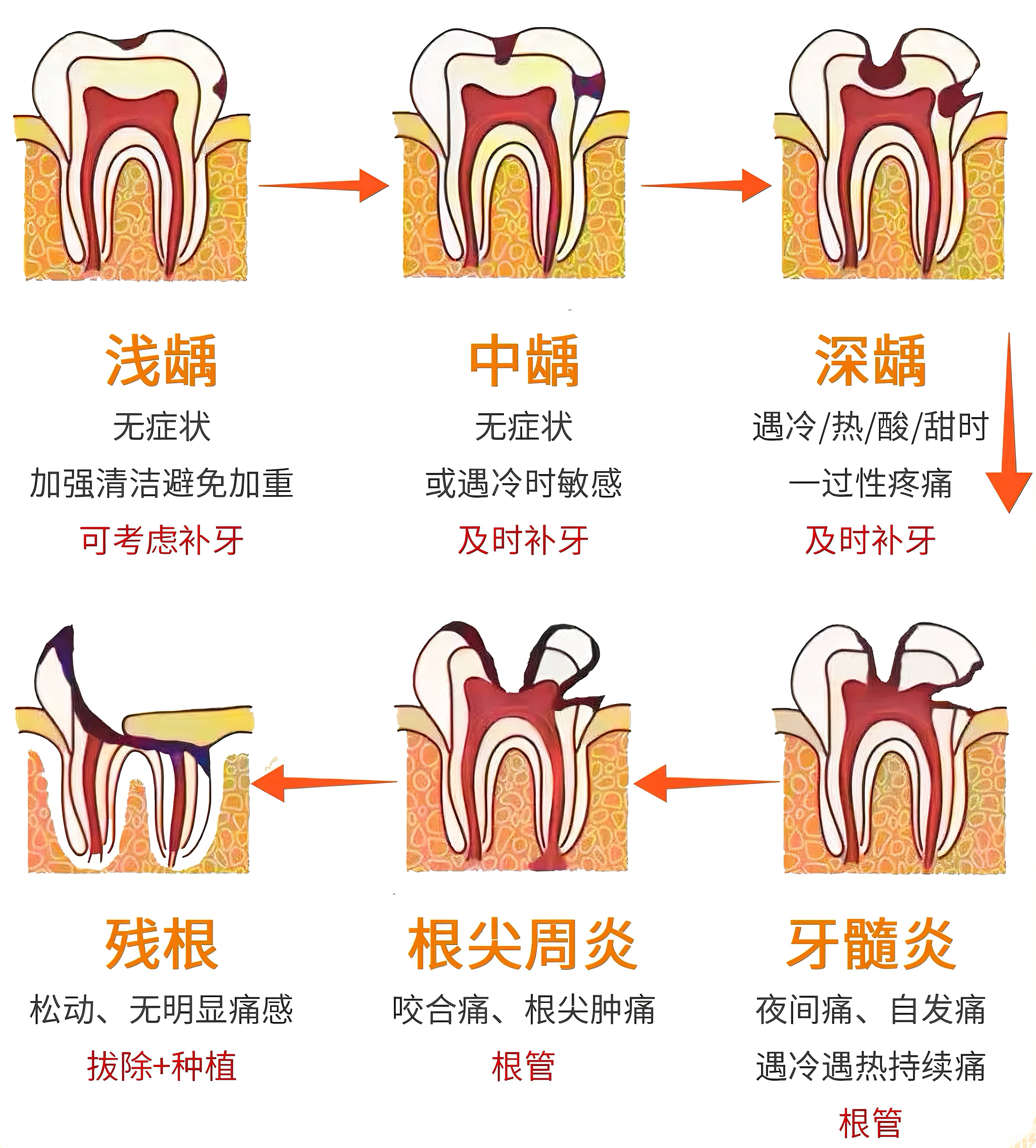 三康口腔龋齿