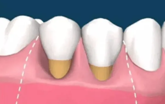 深圳维港口腔 深圳维港口腔