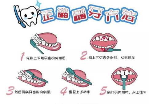 預防齲齒的有效辦法？深圳補牙價錢？